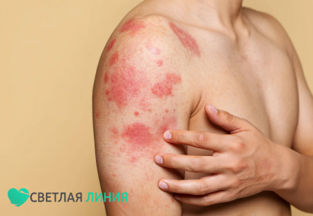 У человека аллергия